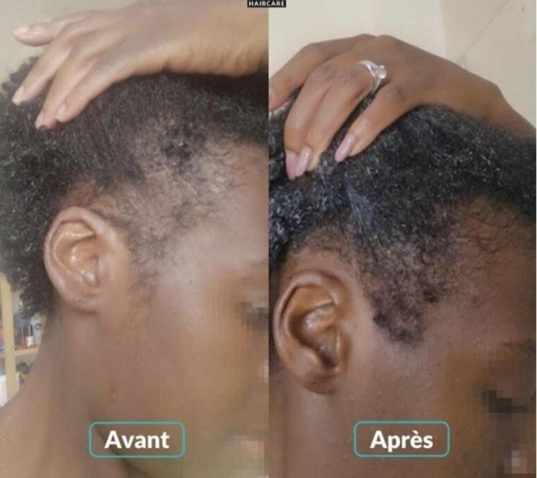 Jovah Pure growth oil  1OZ